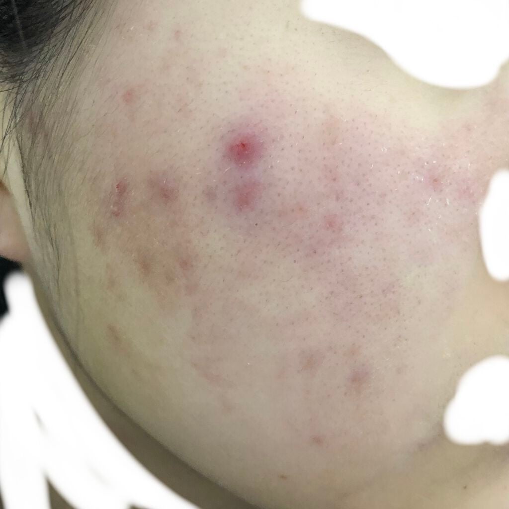 ð£ on LIPS ã2æ¥ç®..ãïŒ2æç®ïŒ