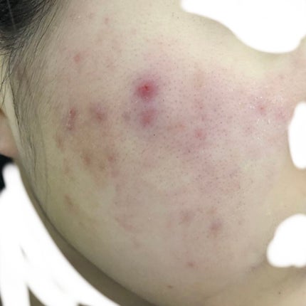 を使ったクチコミ(2枚目)