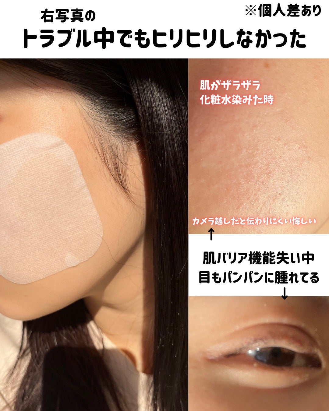 ティーツリー トラブルパッド/MEDIHEAL/トナーパッドを使ったクチコミ(6枚目)