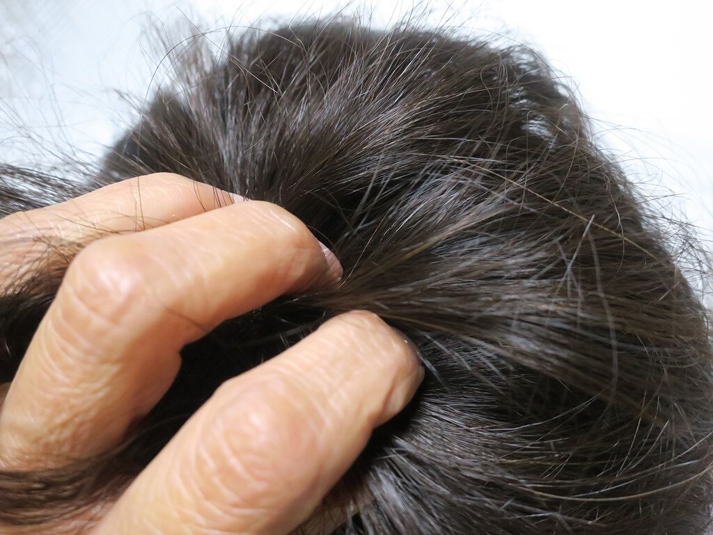 スカルプエッセンス/ヘアモア/頭皮ローションを使ったクチコミ（3枚目）