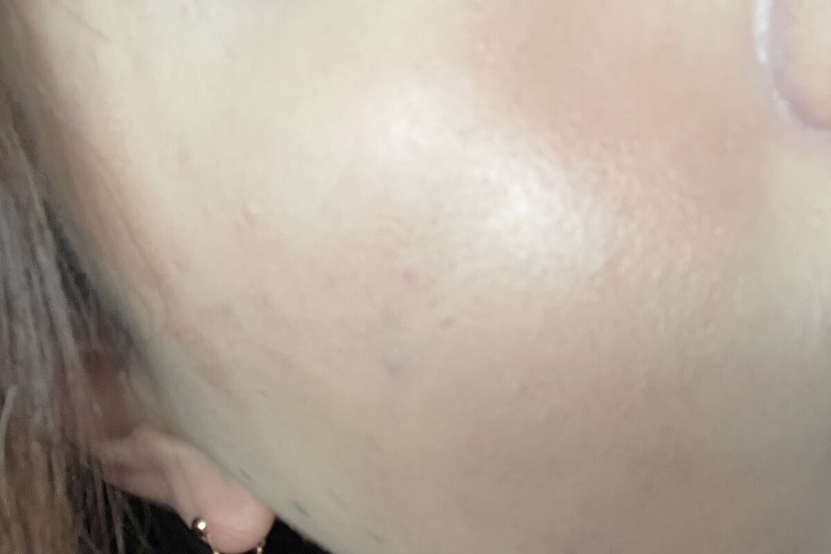 ドクダミ 77 スージングトナー/Anua/化粧水を使ったクチコミ（1枚目）