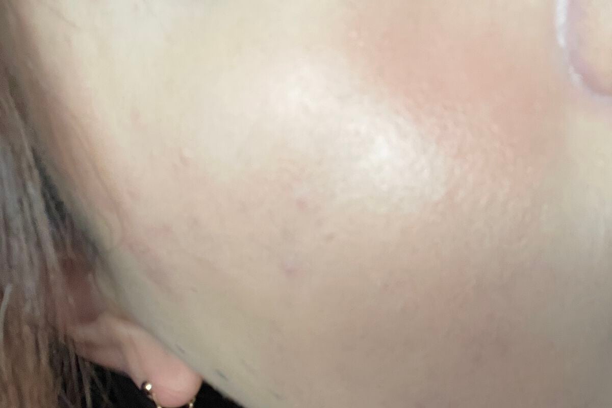 ドクダミ 77 スージングトナー/Anua/化粧水を使ったクチコミ(1枚目)