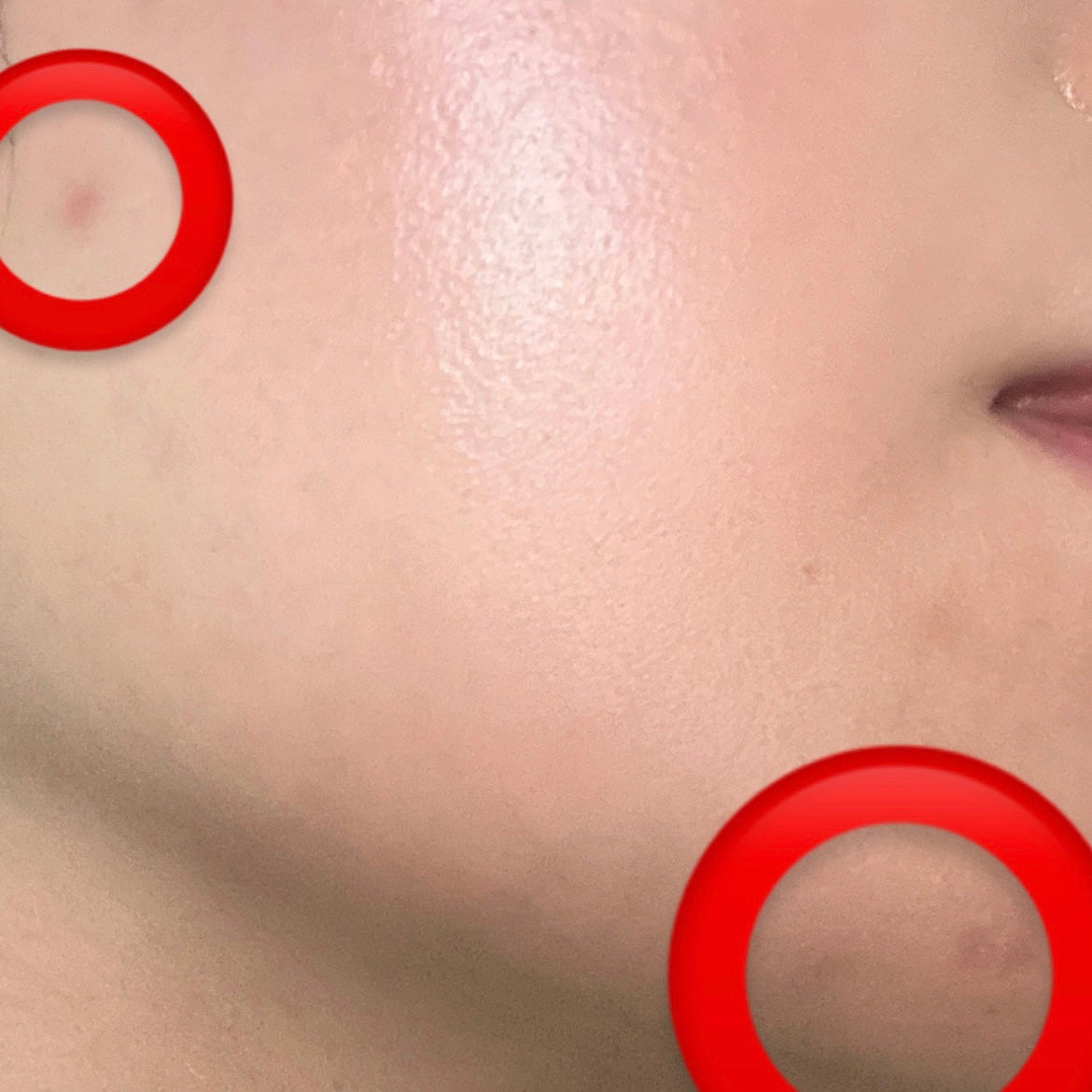 ダーマシンコンシーラー/23years old/リキッドコンシーラーを使ったクチコミ(3枚目)