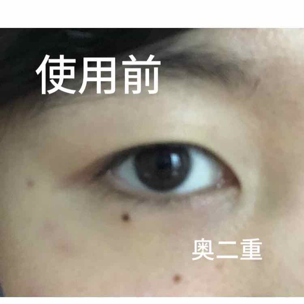ナチュラルアイテープ/ビューティーワールド/二重まぶた用アイテムを使ったクチコミ(2枚目)