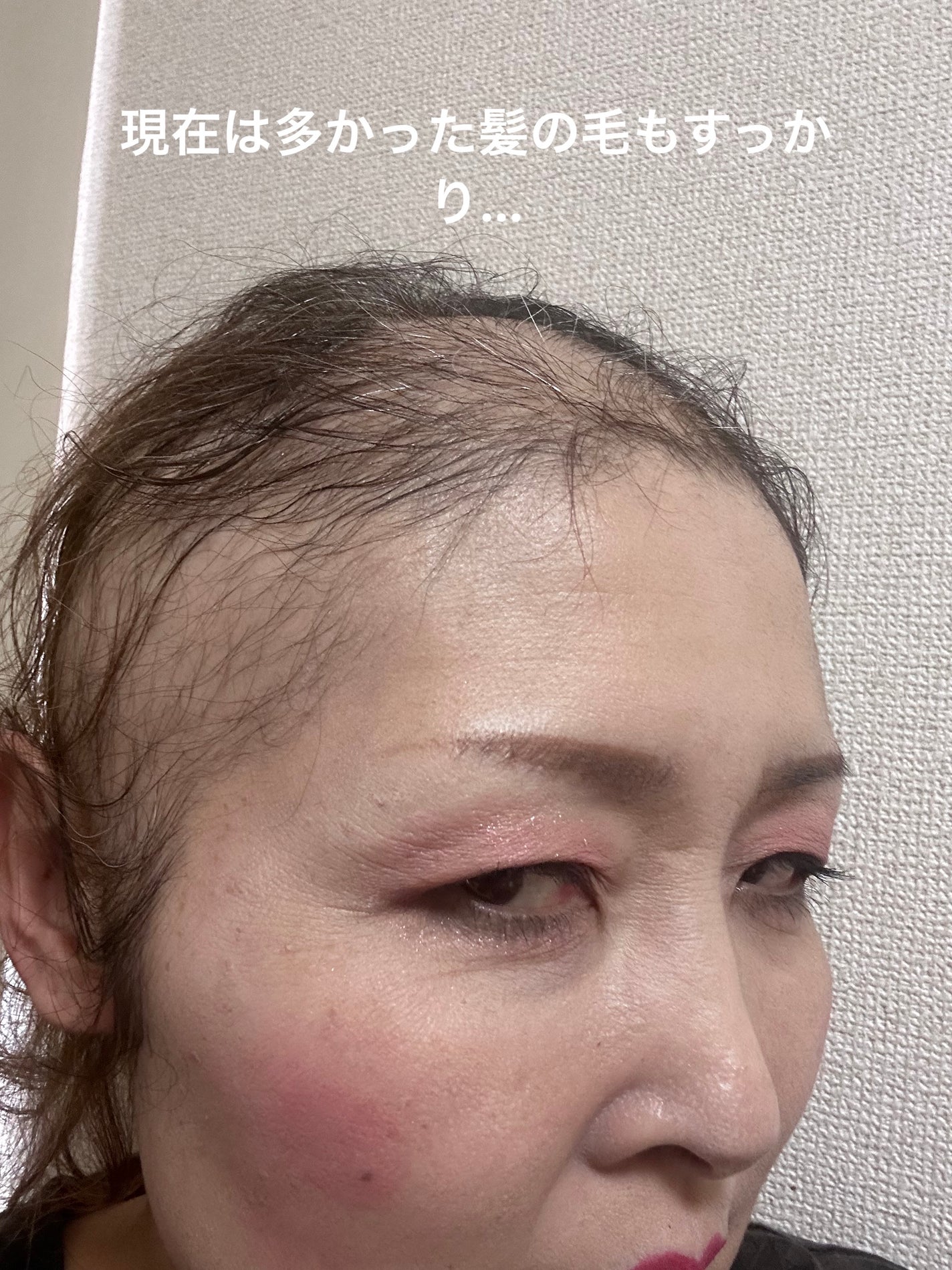 サンカットR プロテクトUV スプレー/サンカット®/日焼け止めミスト・スプレーを使ったクチコミ(2枚目)