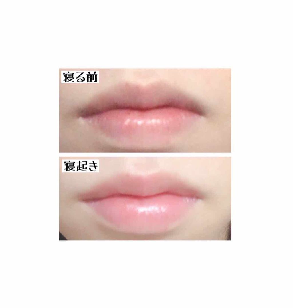 フジコ 朝可愛リップ/Fujiko/リップクリームを使ったクチコミ（3枚目）