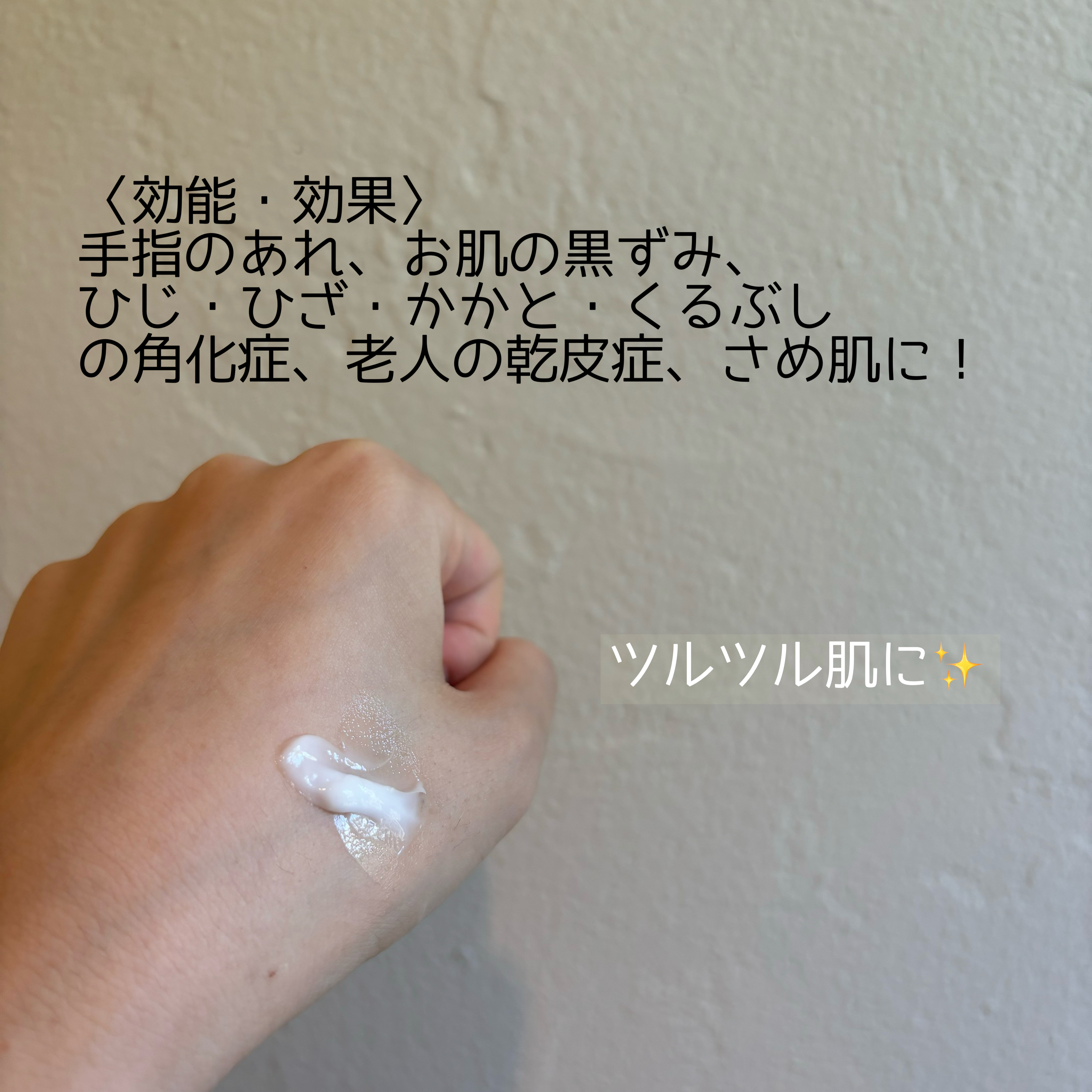 U20クリーム(医薬品)/メンターム/その他を使ったクチコミ（2枚目）