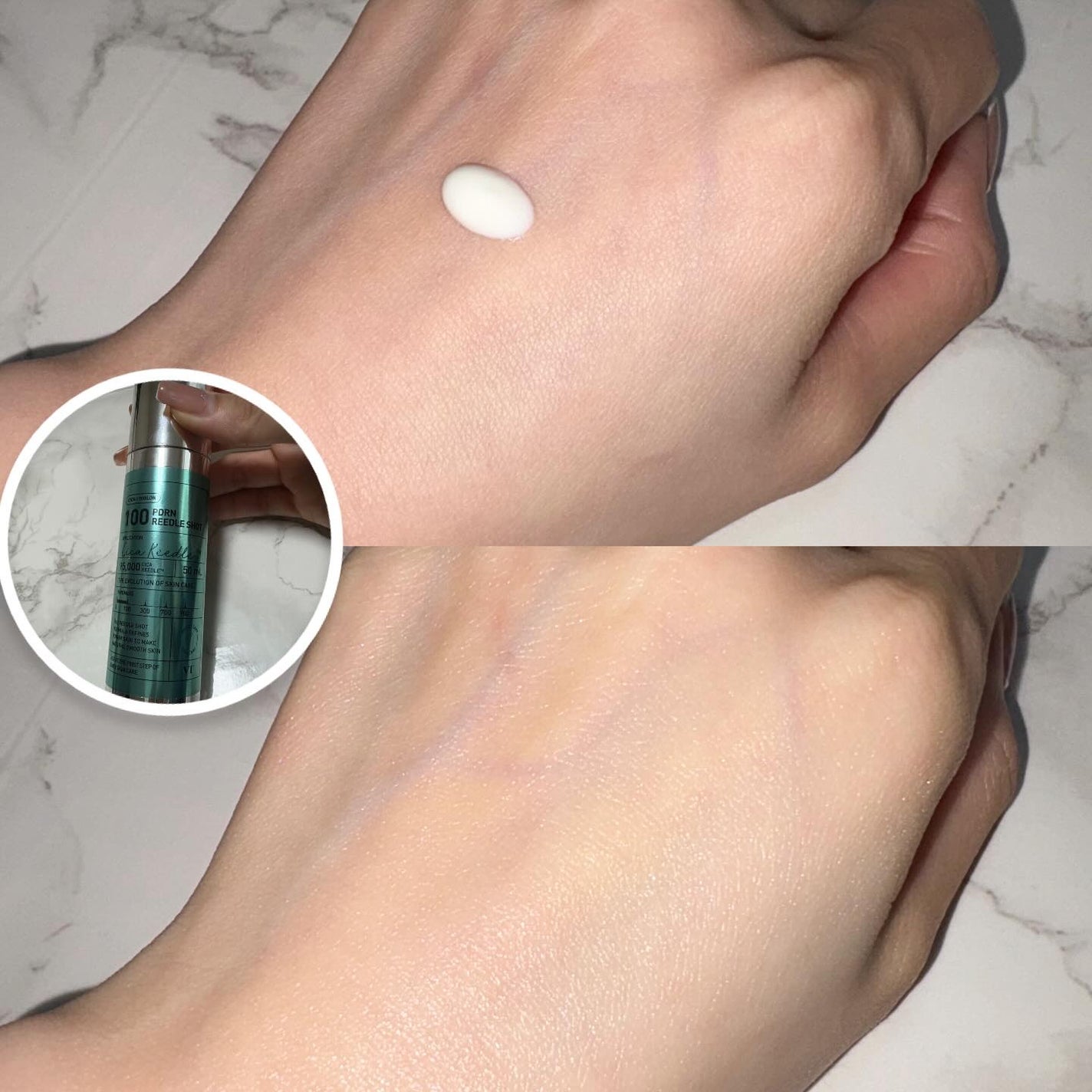 PDRN+リードルS 100/VT/美容液を使ったクチコミ(3枚目)