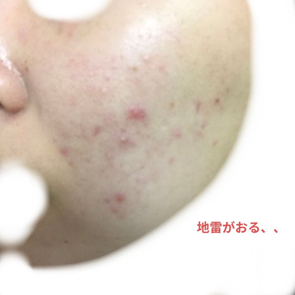 デュオ ザ クレンジングバーム クリア/DUO/クレンジングバームを使ったクチコミ(3枚目)