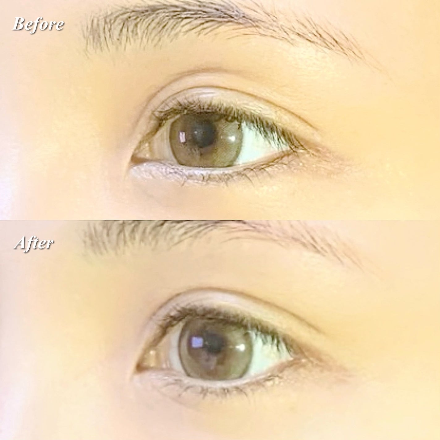 メザイク クリップ カッター ファイバー専用カッター/メザイク/二重まぶた用アイテムを使ったクチコミ(7枚目)