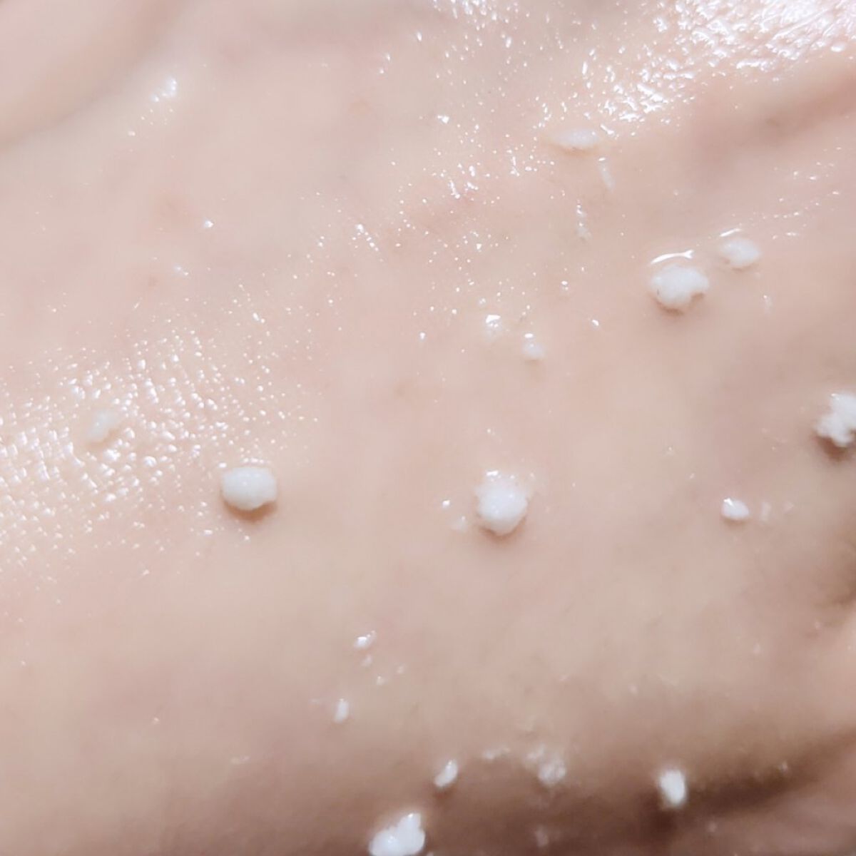 美白乃美人ピーリングジェル/ブレーンコスモス/ピーリングを使ったクチコミ（3枚目）