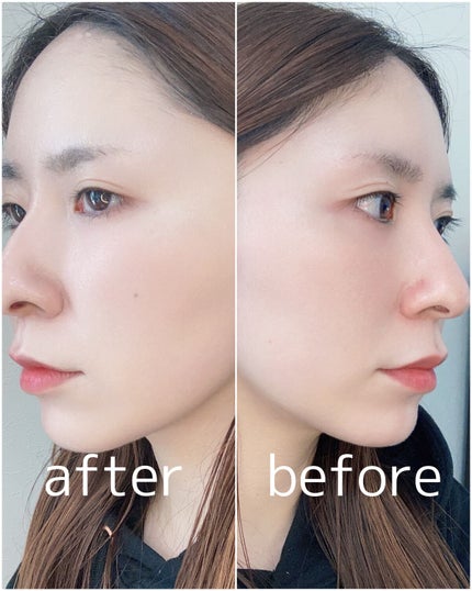 サテンウエアヘルシーグリーンクッション/unleashia/クッションファンデーションを使ったクチコミ(5枚目)