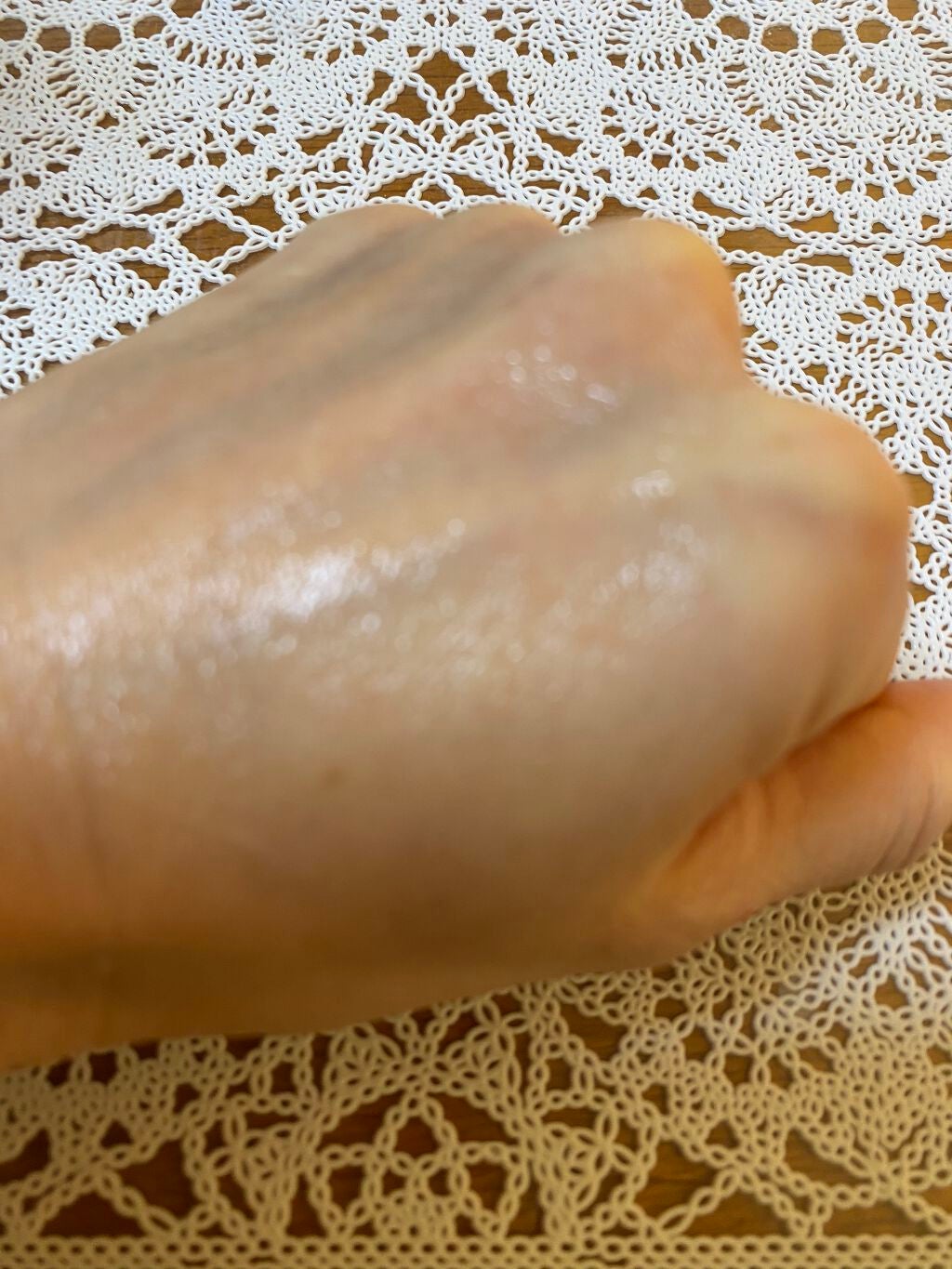 薬用オルリッチ/エクスボーテ/乳液を使ったクチコミ(4枚目)