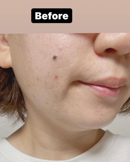 ACジェルクレンジング/NIKI PITA/クレンジングジェルを使ったクチコミ(7枚目)