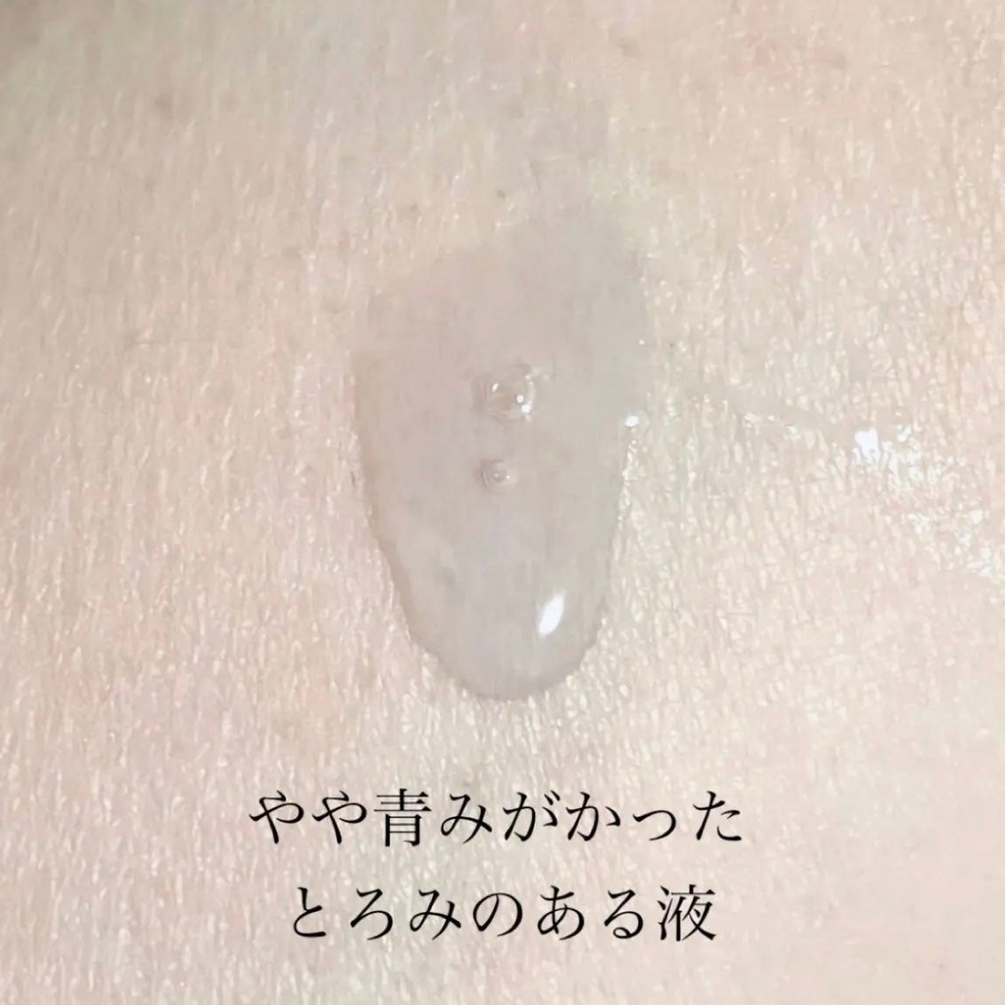 ゼロ毛穴1DAYセラム/MEDICUBE/美容液を使ったクチコミ(2枚目)