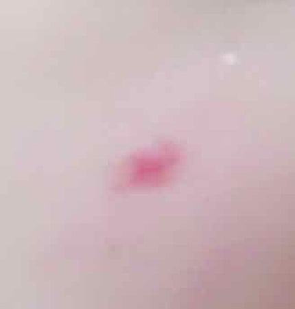 クラリファイング ローション 2/CLINIQUE/拭き取り化粧水を使ったクチコミ(2枚目)