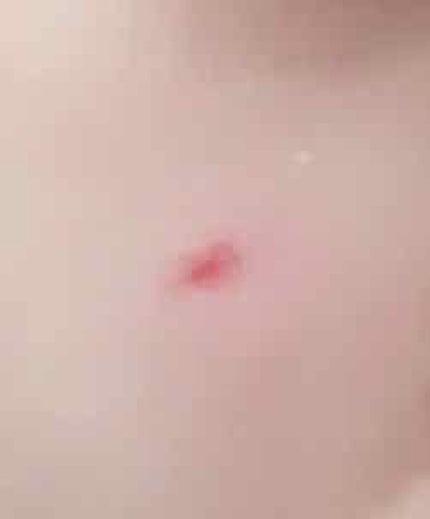 クラリファイング ローション 2/CLINIQUE/拭き取り化粧水を使ったクチコミ(3枚目)