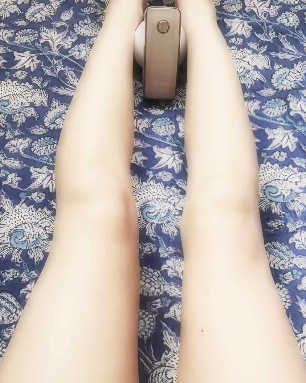 アセチノメガシェイプ/ヤーマン/ヘッドマッサージャーを使ったクチコミ(1枚目)