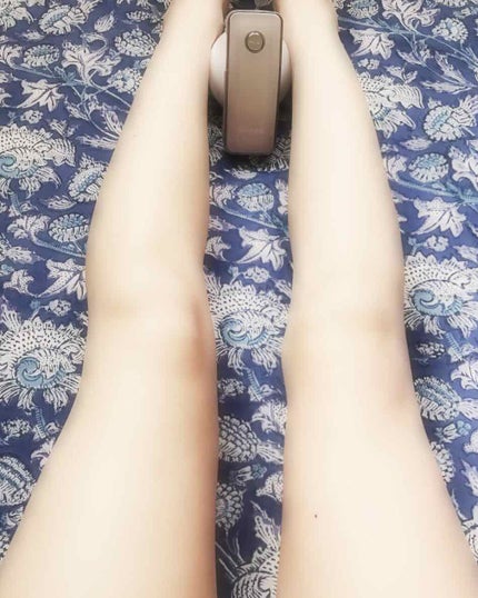 アセチノメガシェイプ/ヤーマン/ヘッドマッサージャーを使ったクチコミ(1枚目)