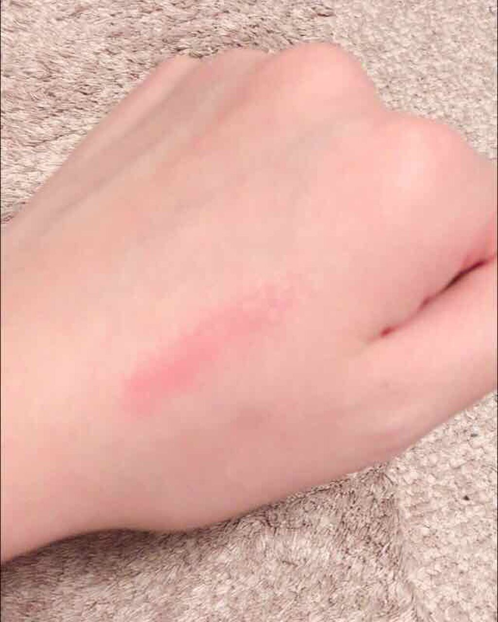 オペラ シアーリップカラー RN/OPERA/リップグロスを使ったクチコミ(2枚目)