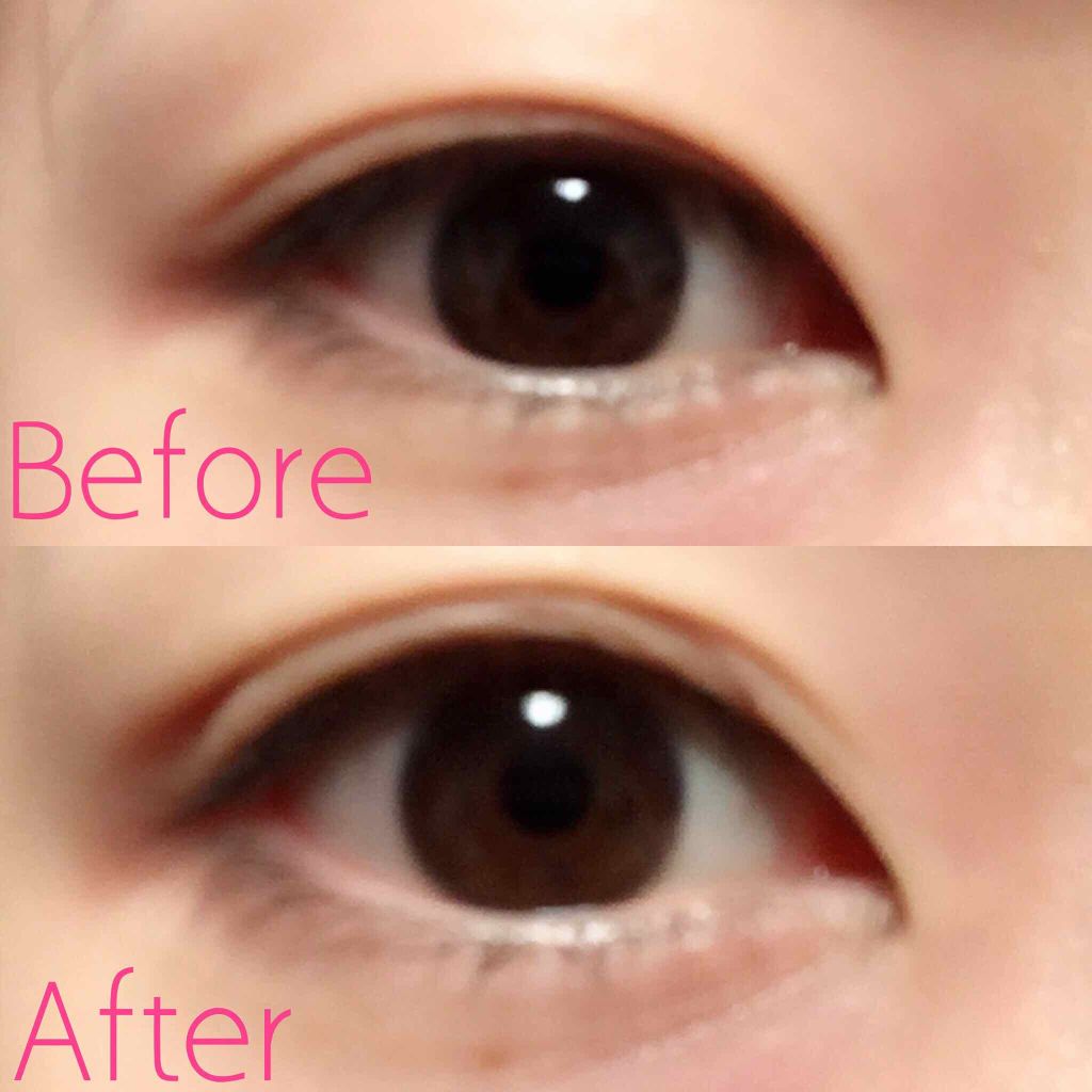 アイトーク/アイトーク/二重まぶた用アイテムを使ったクチコミ(1枚目)