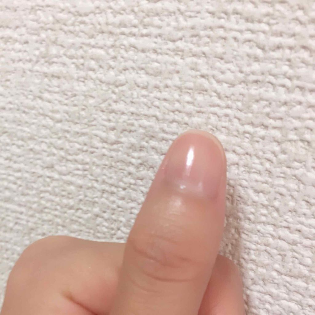 ウィンマックス ネイルケアシリーズ ベースコート/DAISO/ネイルベースコートを使ったクチコミ（1枚目）