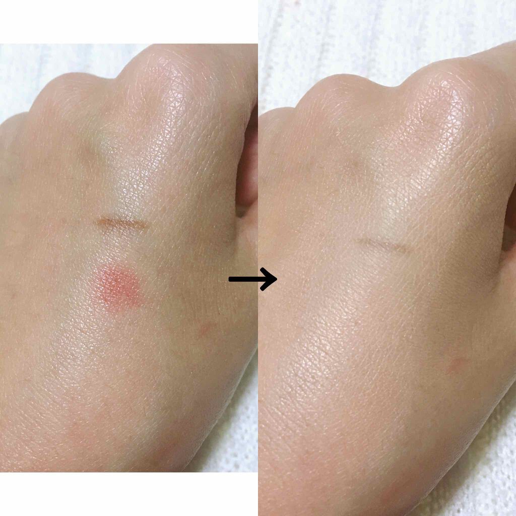 AC ハイカバーマット リキッドファンデーション/AC by Angelcolor/リキッドファンデーションを使ったクチコミ(2枚目)