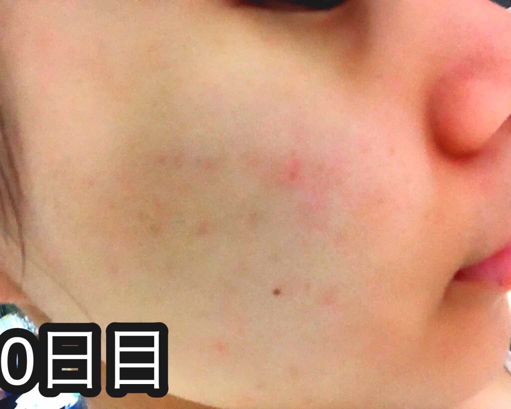 オーガニック炭酸ホワイトパック/Sing/洗い流すパック・マスクを使ったクチコミ(2枚目)