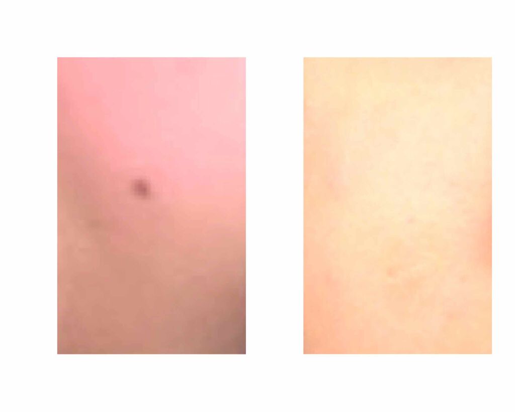 スポッツカバー ファウンデイション/SHISEIDO/クリームコンシーラーを使ったクチコミ(2枚目)