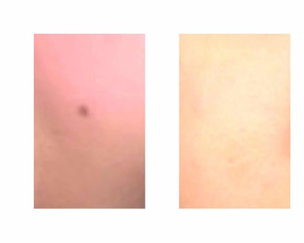 スポッツカバー ファウンデイション/SHISEIDO/クリームコンシーラーを使ったクチコミ(2枚目)