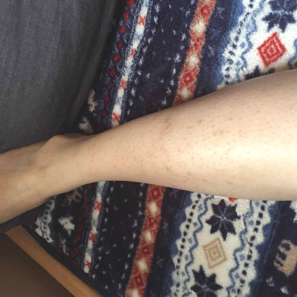 スキンフェイドクリーム/デルミサ/フェイスクリームを使ったクチコミ(3枚目)