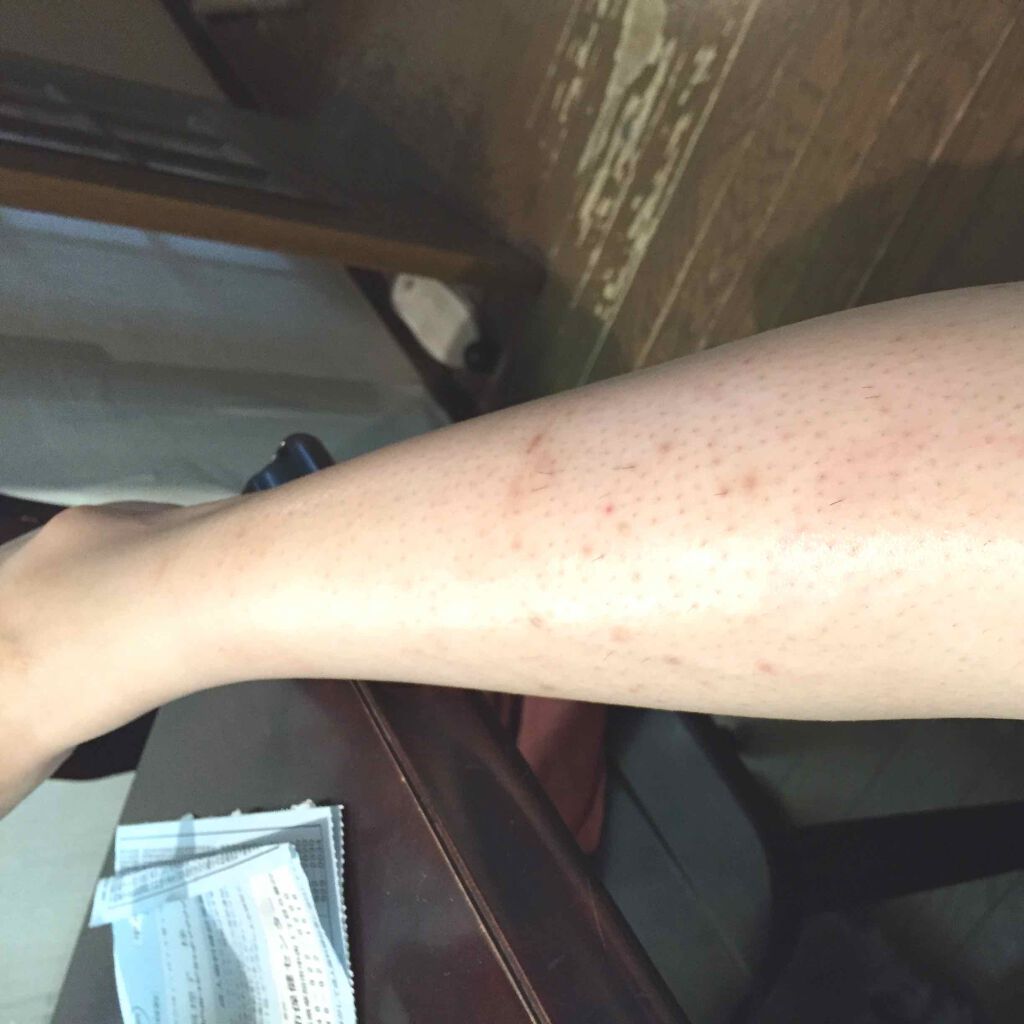 スキンフェイドクリーム/デルミサ/フェイスクリームを使ったクチコミ（2枚目）