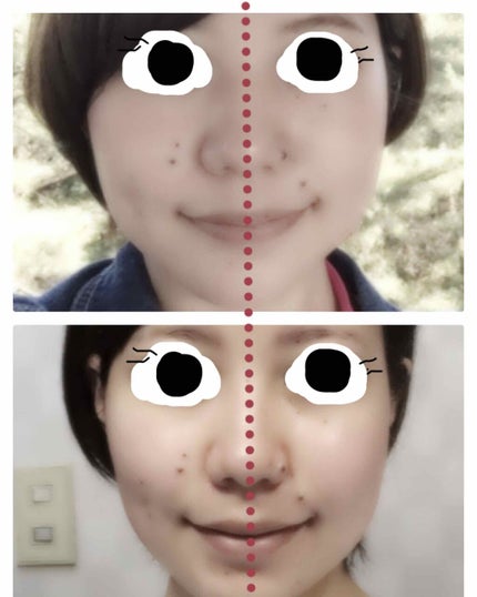 リフトレージュ 遠赤外線ローラーフェイス用/ベス/その他スキンケアグッズを使ったクチコミ(2枚目)