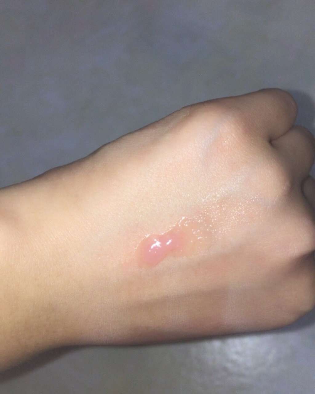 チューシー リップスクラブ ベビーフローラル/Pure Smile/リップスクラブを使ったクチコミ(2枚目)