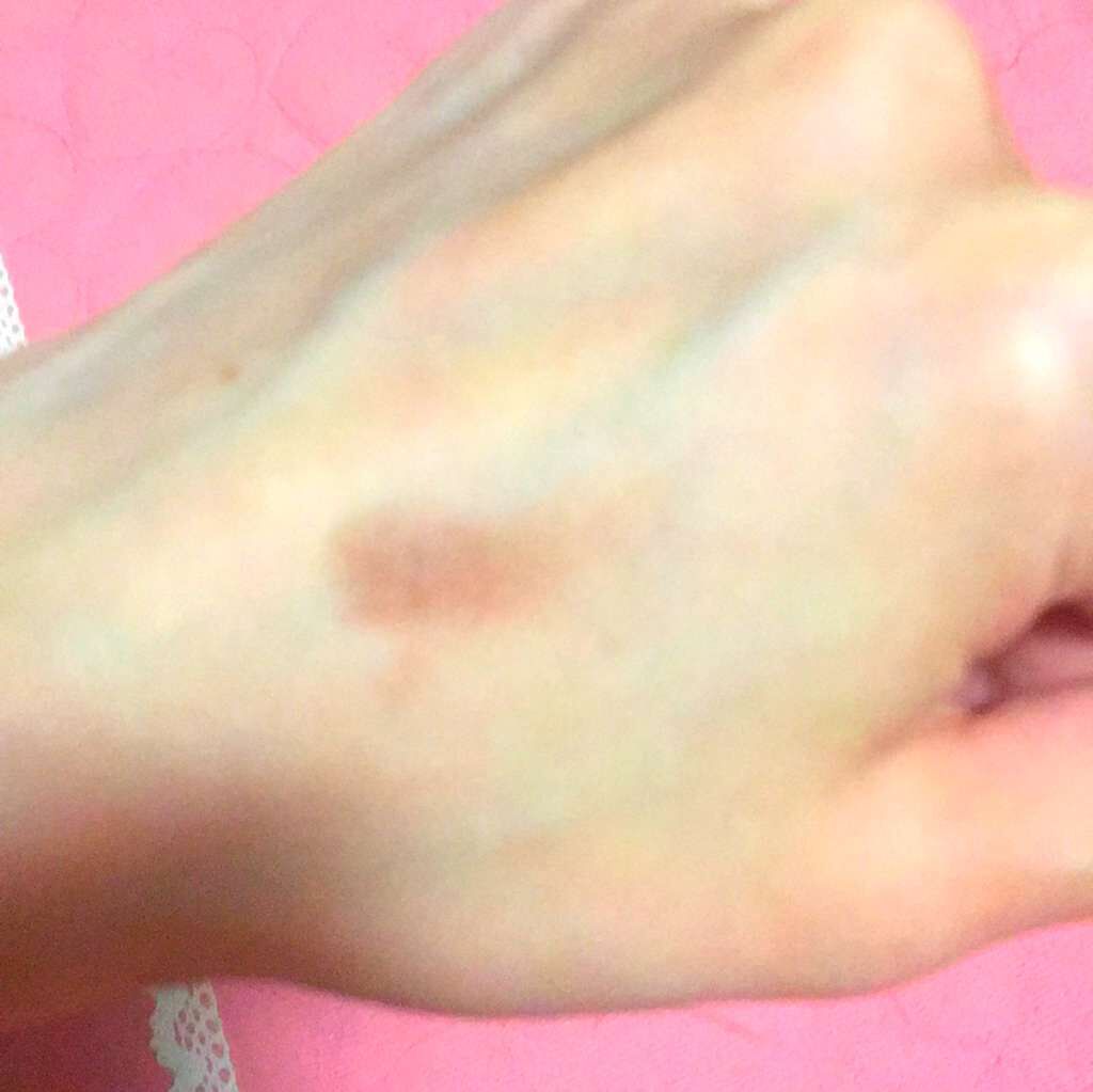 アイシャンプーロング/メディプロダクト/その他洗顔料を使ったクチコミ（3枚目）