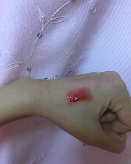 ウォーターティント/ETUDE/リップグロスを使ったクチコミ(2枚目)