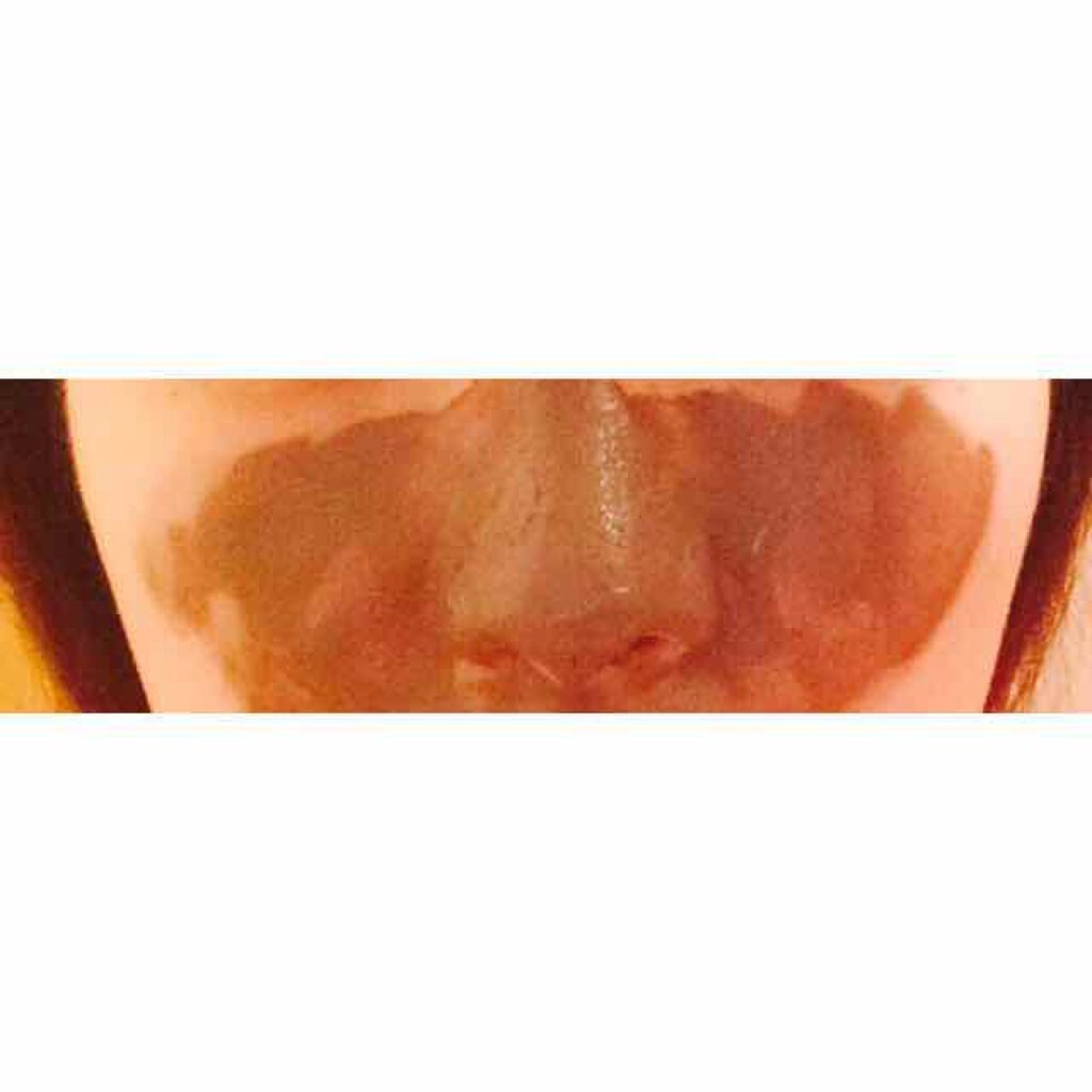 ツルリ 皮脂吸い出し 部分用パック ガスール&レッドパワー/ツルリ/洗い流すパック・マスクを使ったクチコミ(2枚目)