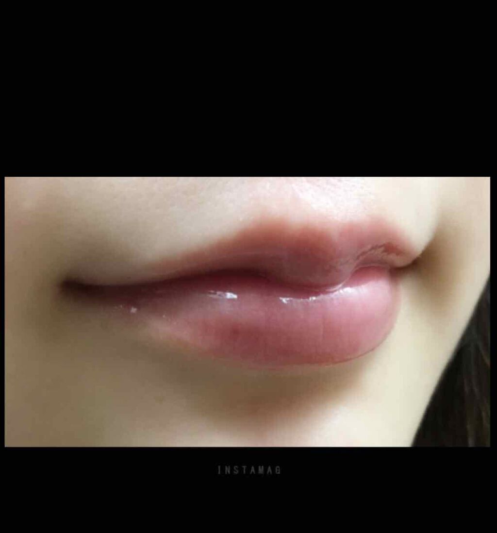 38°C / 99°F リップトリートメント (リップ美容液)/UZU BY FLOWFUSHI/リップケアを使ったクチコミ(2枚目)