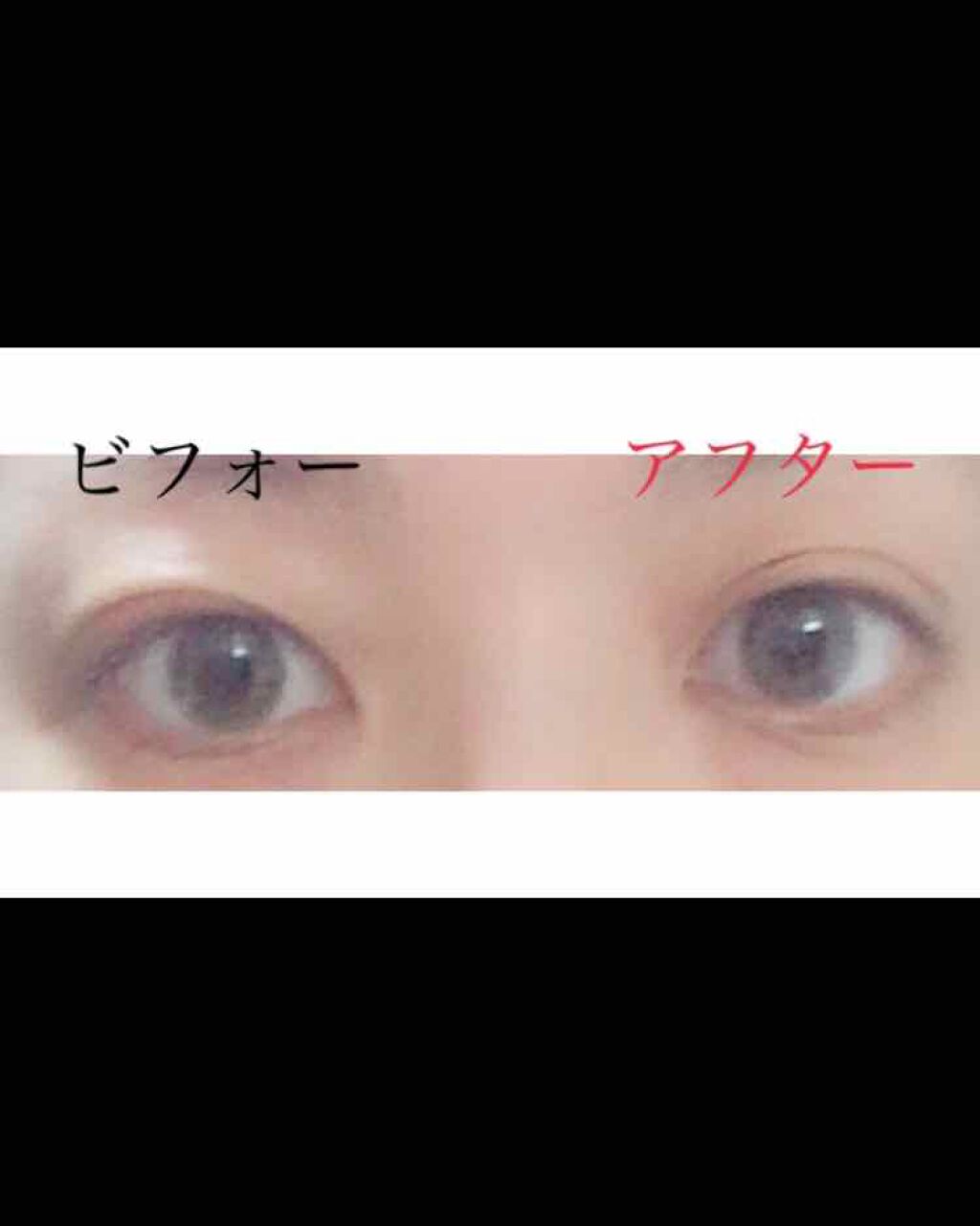 のびーるアイテープ(絆創膏タイプ、レギュラー)/DAISO/二重まぶた用アイテムを使ったクチコミ(2枚目)