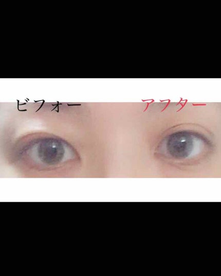 のびーるアイテープ(絆創膏タイプ、レギュラー)/DAISO/二重まぶた用アイテムを使ったクチコミ(2枚目)