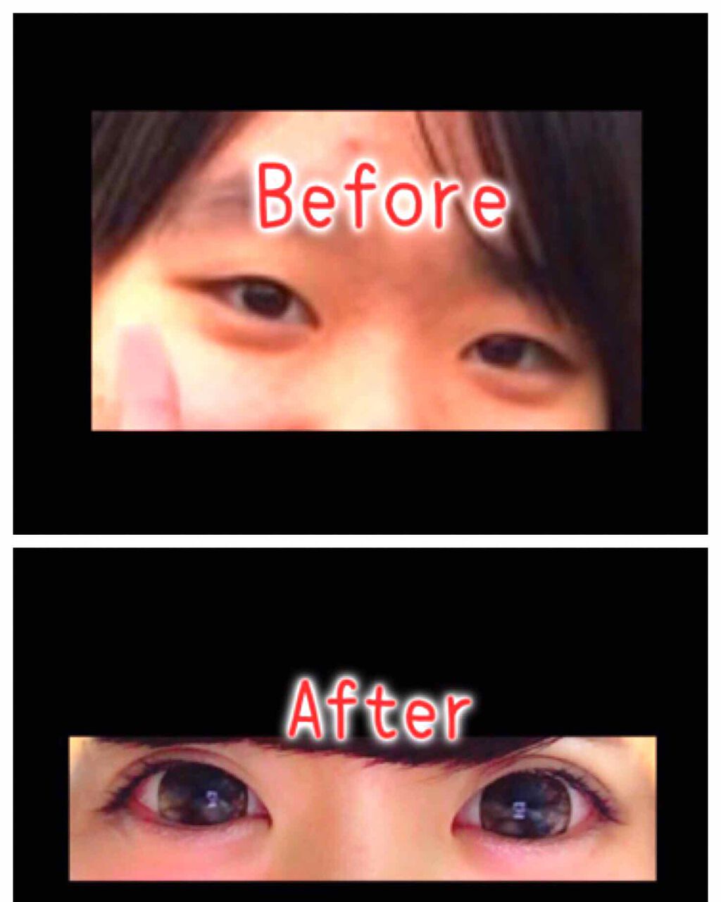 アイテープ 埋没式両面テープ/DAISO/二重まぶた用アイテムを使ったクチコミ(1枚目)