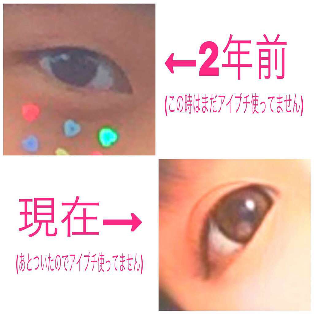 両面二重テープ/DAISO/二重まぶた用アイテムを使ったクチコミ(2枚目)