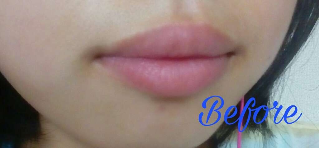 Chu Lip/Chu Lip /リップケアを使ったクチコミ（3枚目）