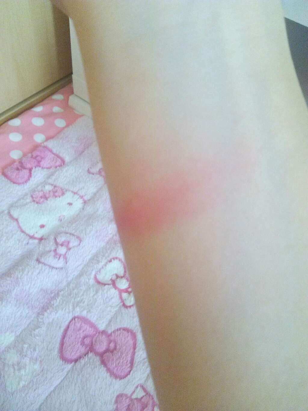 エスポルール クリーミーチーク/エスポルール/ジェル・クリームチークを使ったクチコミ（2枚目）