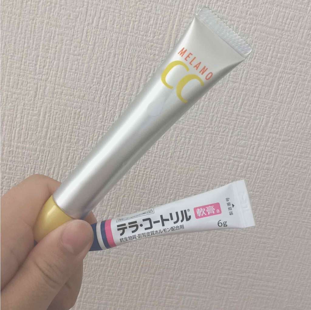 テラ・コートリル 軟膏(医薬品)/ジョンソン・エンド・ジョンソン/その他を使ったクチコミ(2枚目)