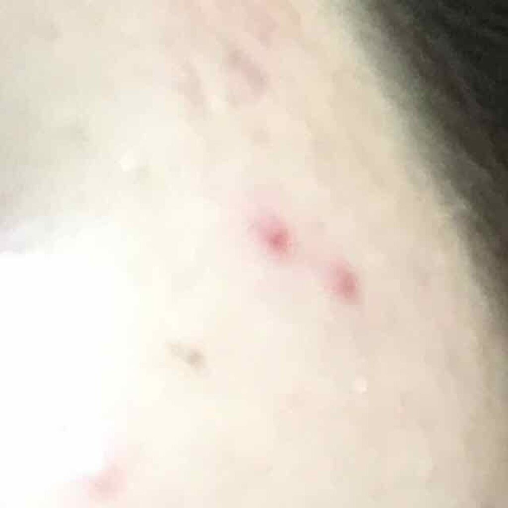 コンシーラー チップタイプ/無印良品/リキッドコンシーラーを使ったクチコミ（2枚目）