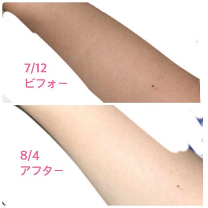 ニベアソフト スキンケアクリーム/ニベア/ボディクリームを使ったクチコミ(1枚目)