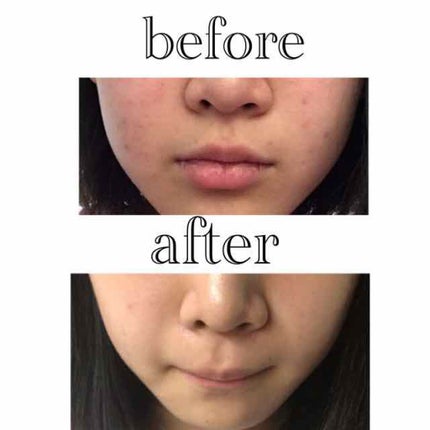 ハトムギ化粧水(ナチュリエ スキンコンディショナー R )/ナチュリエ/化粧水を使ったクチコミ(1枚目)