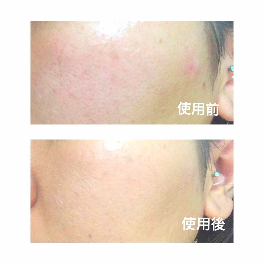 SP BB モイストマット/MAYBELLINE NEW YORK/BBクリームを使ったクチコミ(3枚目)