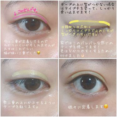 二重になる方法 Lj 二重テープ ヌーディポイント Loujeneの使い方や二重メイク 私の二重事情 元々 By マ イ 普通肌 代前半 Lips